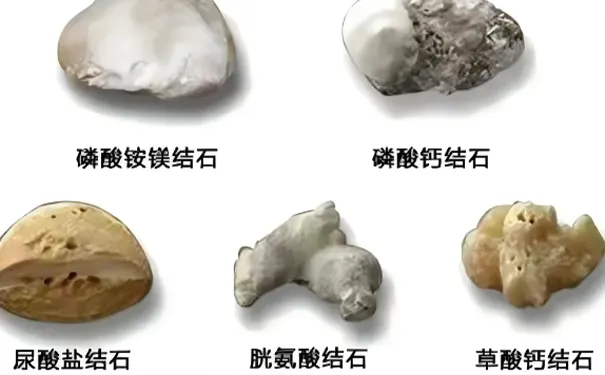 杭州邦尔骨科医院碎石科