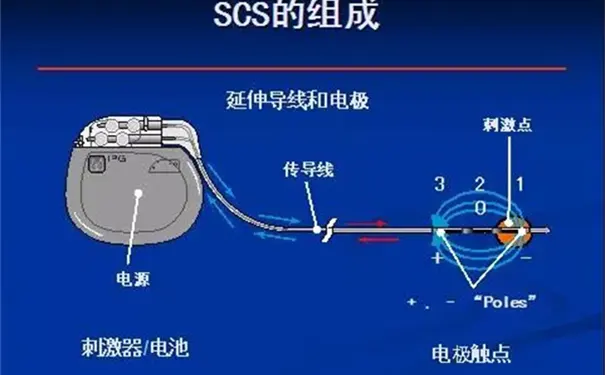 杭州明州姑娘桥康复医院 杭州明州姑娘桥康复医院