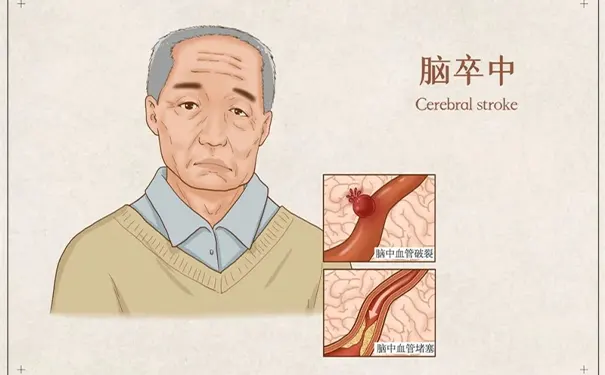 浙江省立同德医院卒中中心