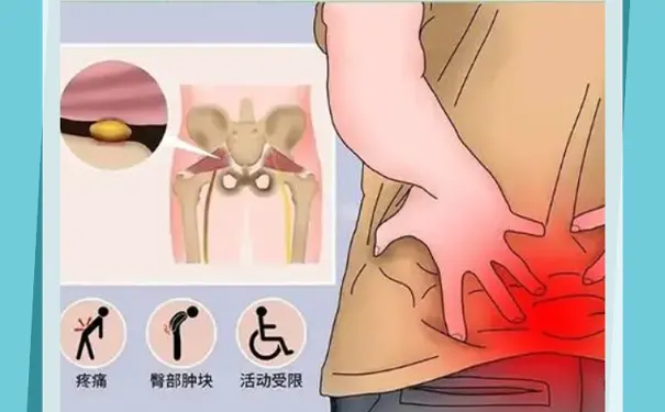 浙一医院康复科 浙一医院康复科